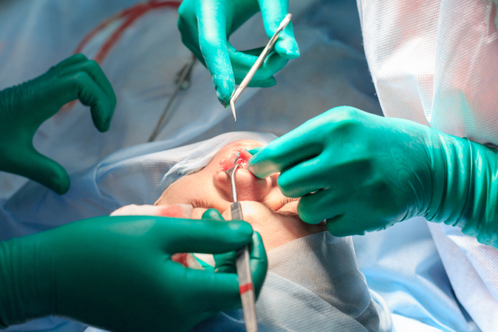A rinoplastia duração da cirurgia pode depender de cada caso e suas demandas.