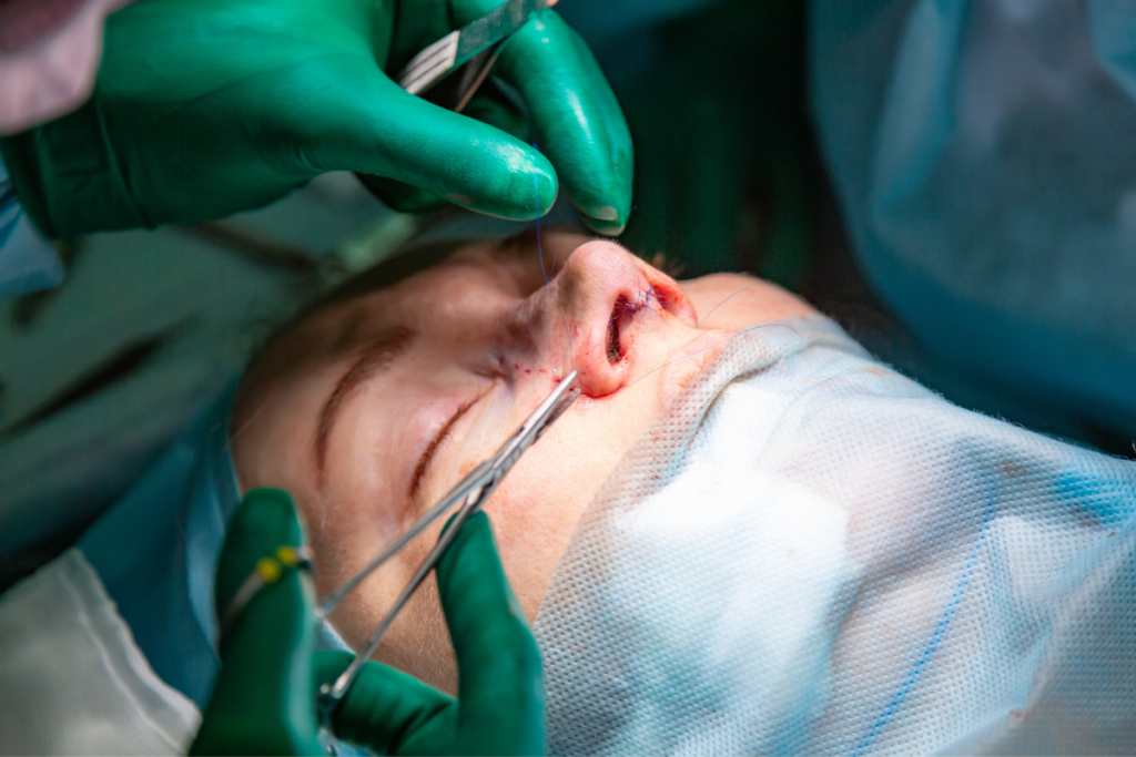Paciente em cirurgia no nariz. Imagem ilustrativa para texto rinoplastia riscos de morte.